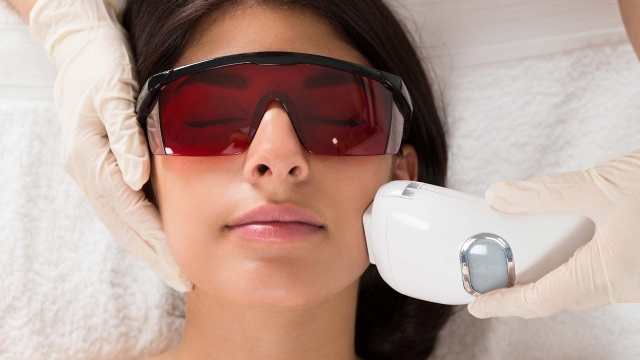 Beating the Burn: Unlocking the Magic of Laser Hair Removal